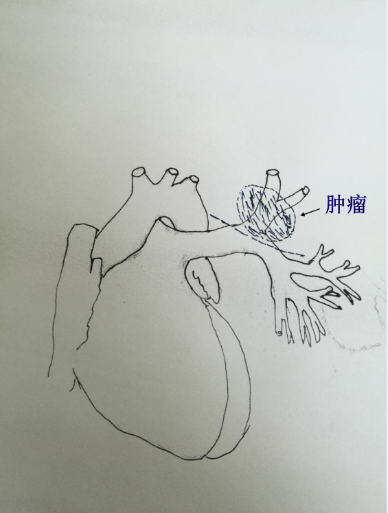 QQ图片20170823144217.png