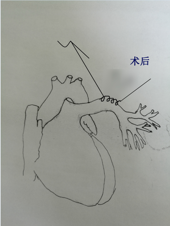 QQ图片20170823144150.png